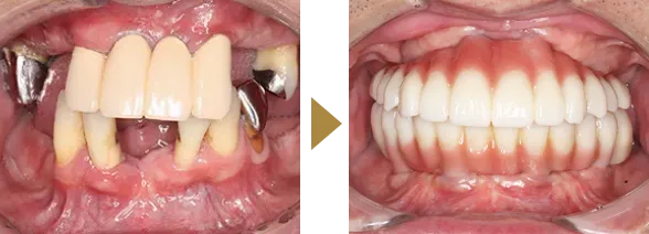 CASE 01