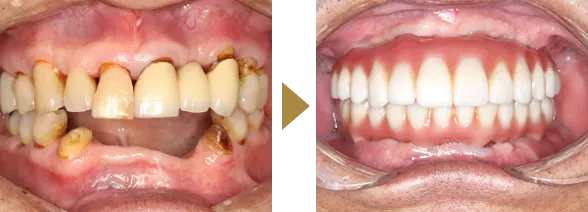CASE 02
