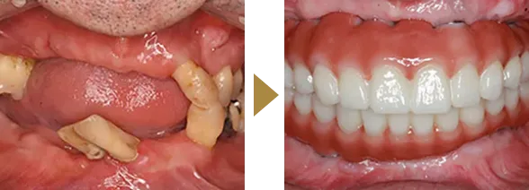 CASE 04