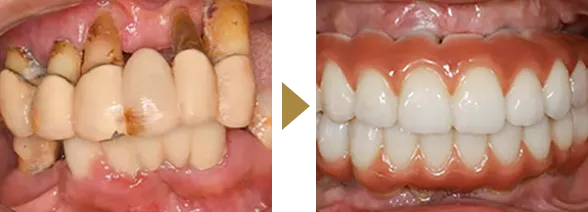 CASE 05