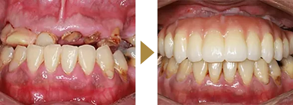 CASE 06
